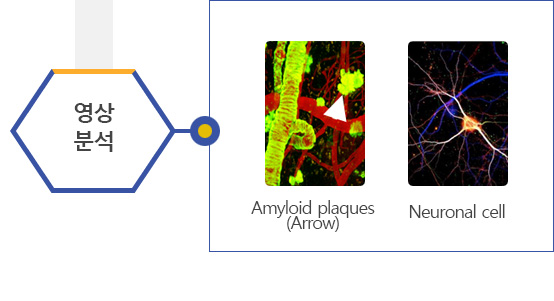 영상분석:Amyloid plaques(Arrow),Neuronal cell